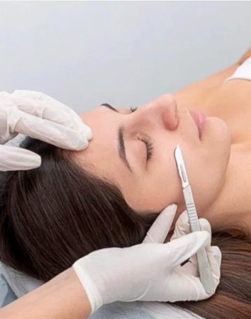 Dermaplaning-new-image-2